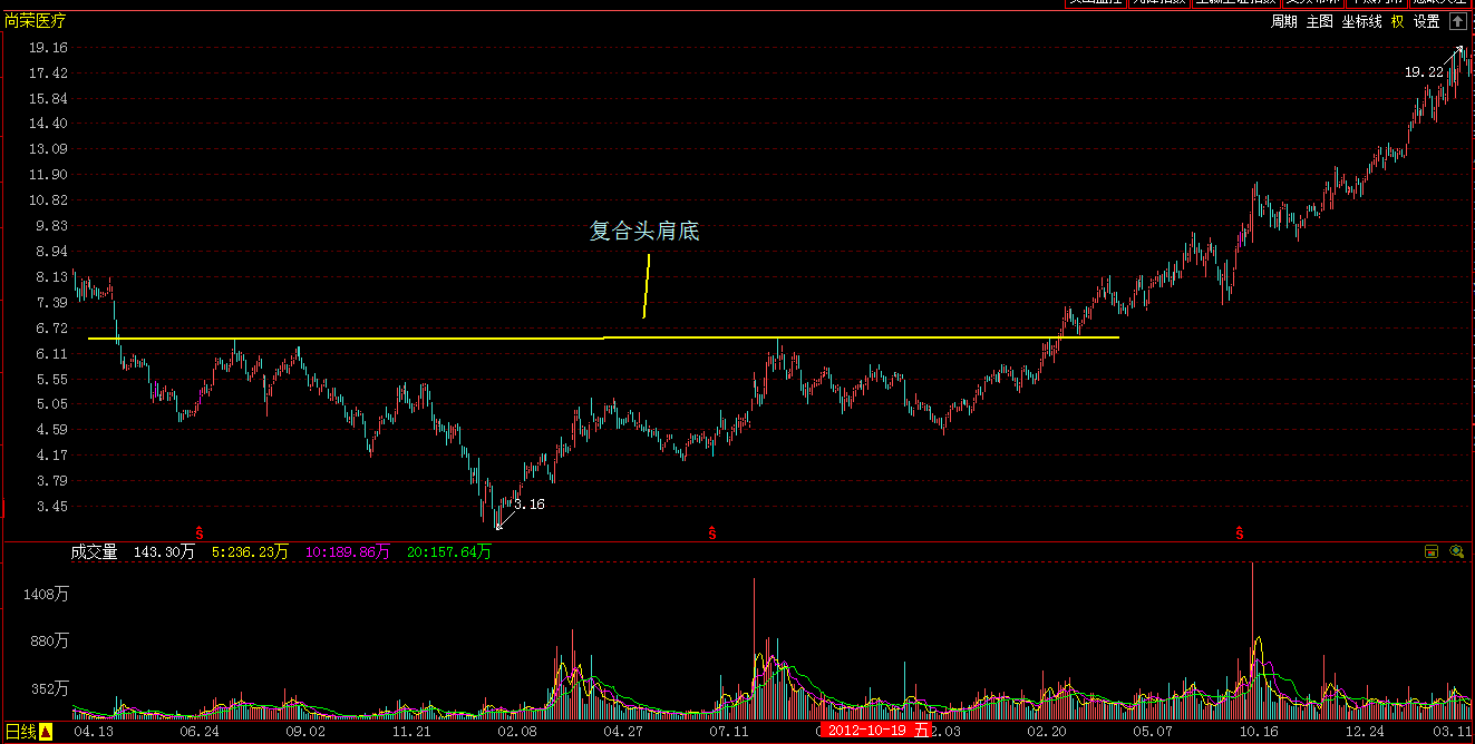 a股市场里的底部形态实例复合头肩底
