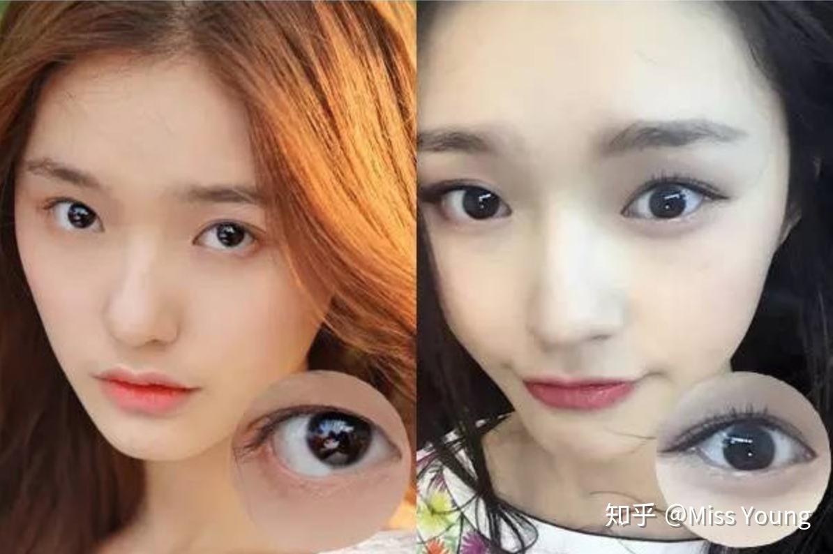 整容的极限是什么? - 知乎