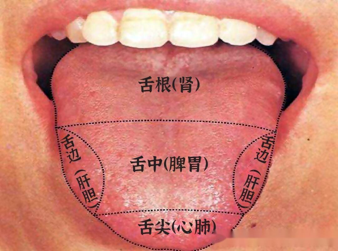 今日患者舌象分析 —— 消化不良、腹胀、脾胃虚，气血虚 肝胆不好 - 哔哩哔哩