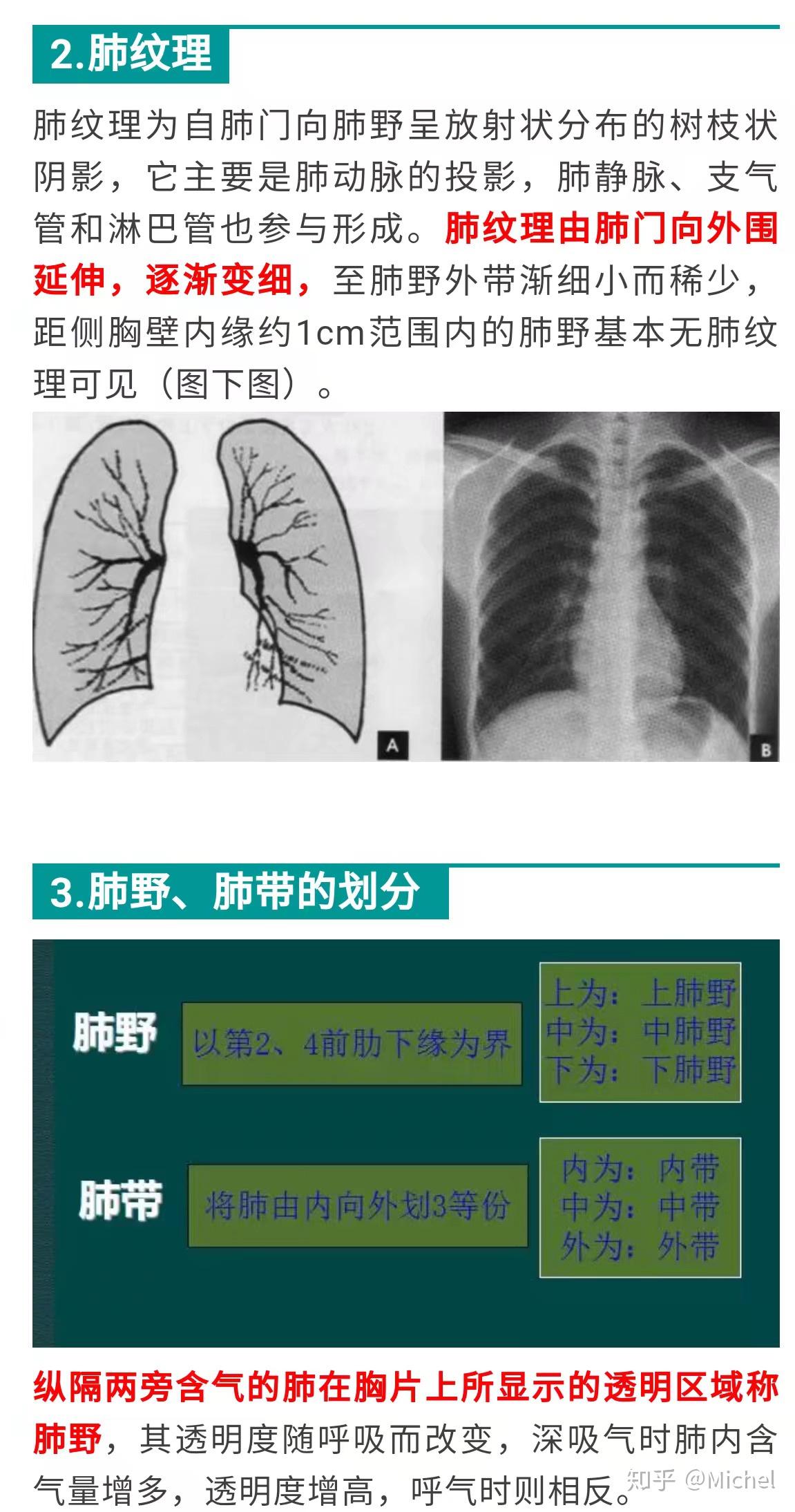 一分钟学会看胸片