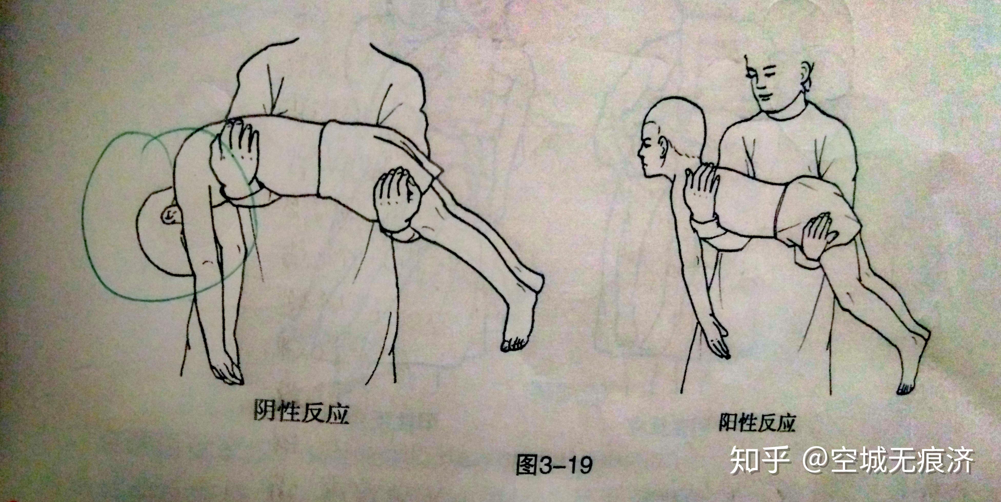 神经反射发育评定