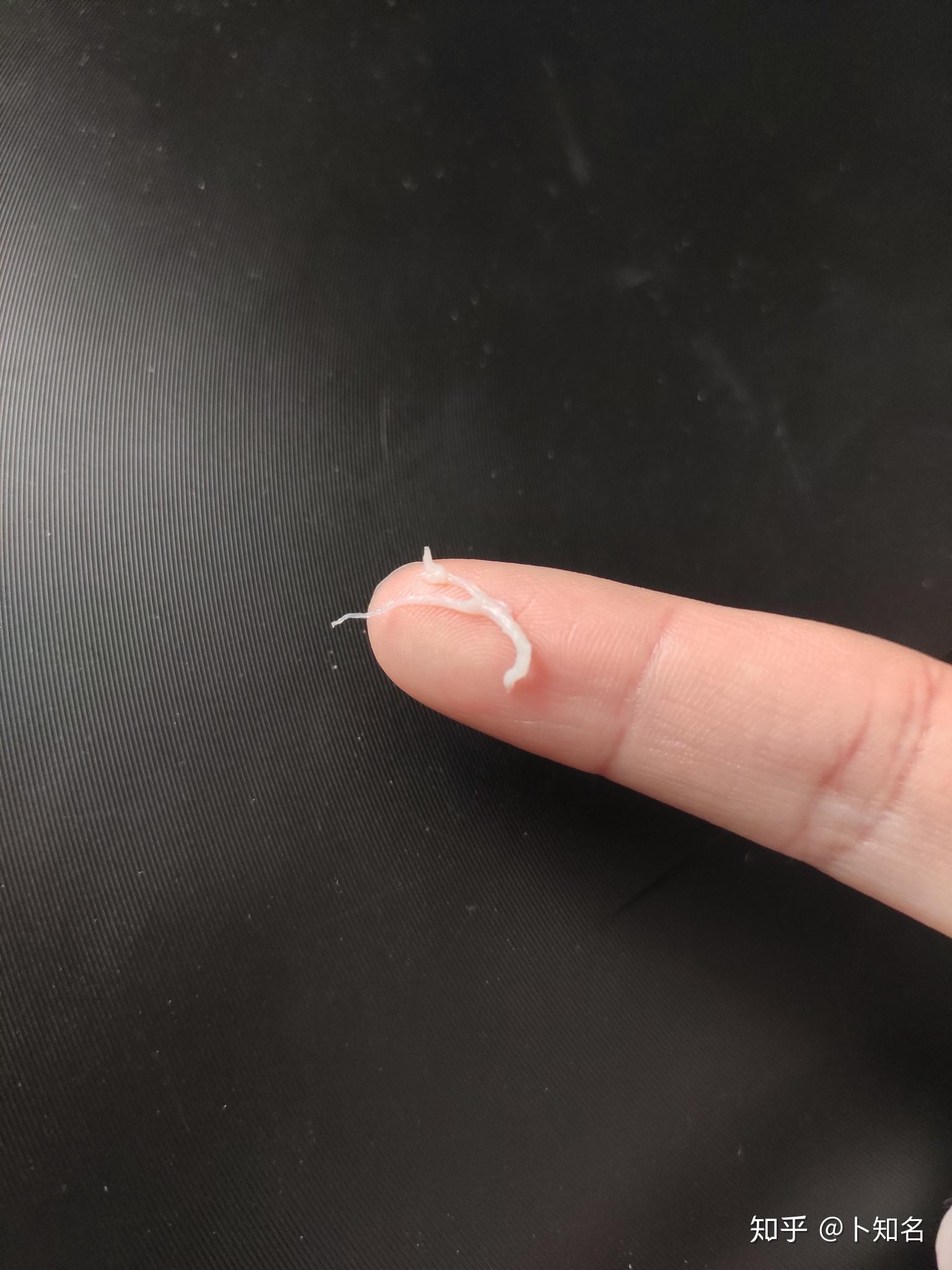 漱口水用后口腔为什么会有白色黏膜