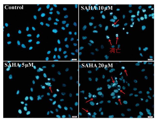 细胞凋亡检测方法——无废话实用指南 知乎