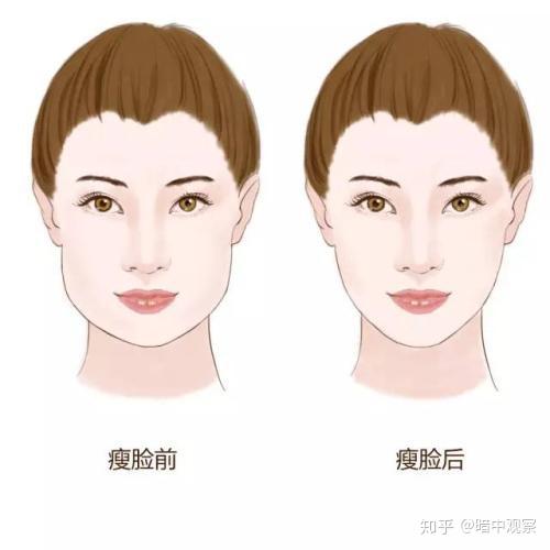 v2-bf942d82a9c5cccda781e2e21bd685c8_r.jpg
