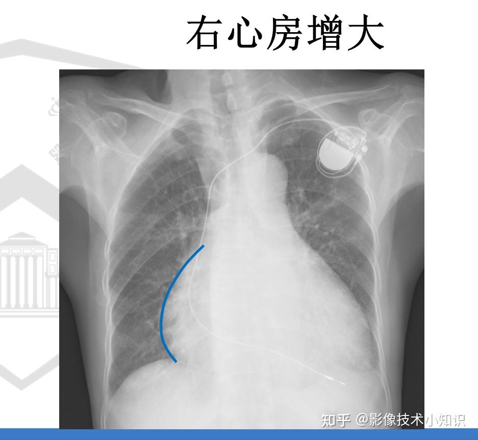 对你很有帮助的心脏影像知识 - 知乎