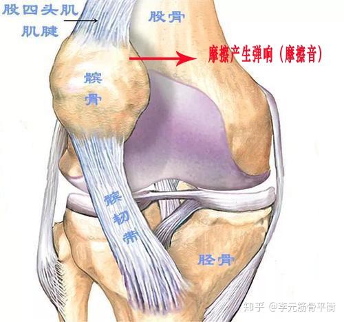 15岁双膝髌骨软化症软骨磨损髌腱炎什么水平我打篮球有什么需要注意的