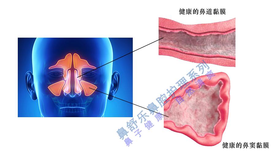 鼻窦炎的治疗方案是什么？ - 知乎