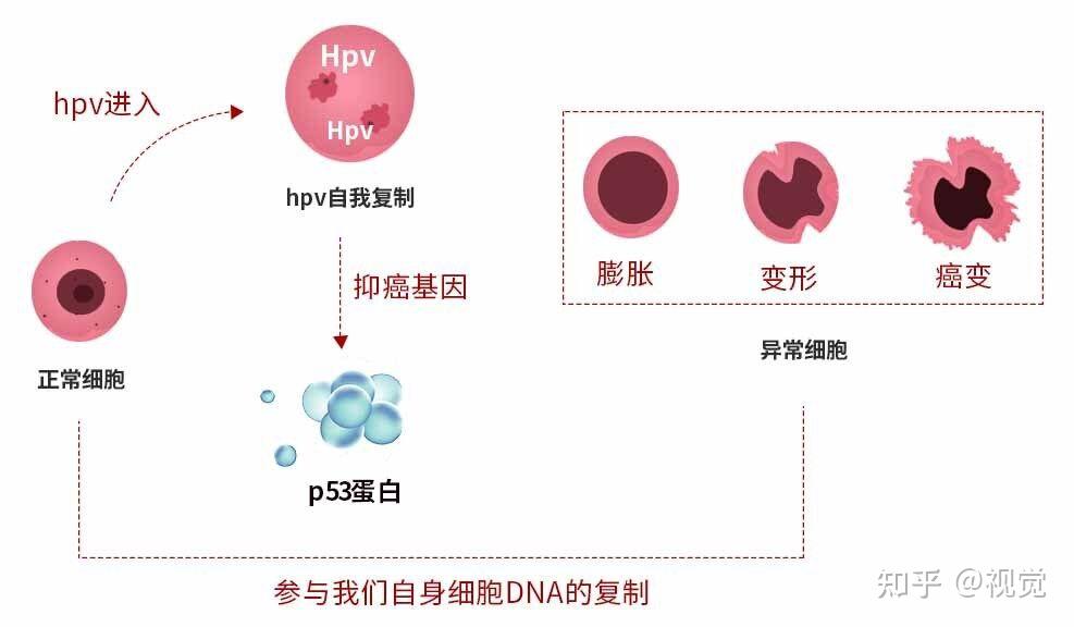 hpv59是什么意思hpv59型阳性是宫颈癌的几率是多少