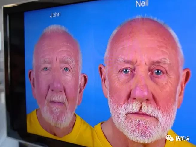 研究双胞胎的顶级教授汤姆 · 史帕达对非遗传血统的两组基因,有如此