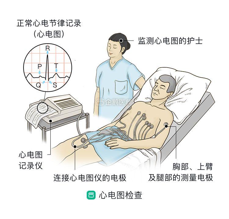 要做什么检查来确诊呢?