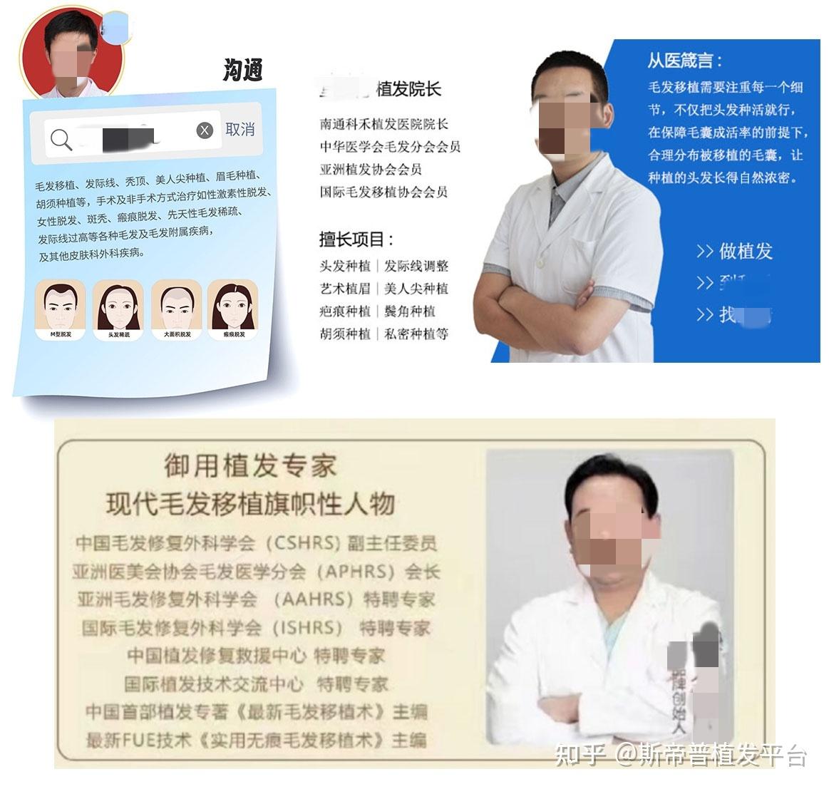 植发医生多大退休(植发医生多大退休年龄)