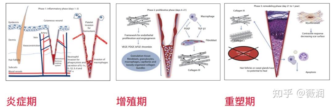 会阴侧切切口愈合不良应该怎么办？重组Ⅲ型人源化胶原蛋白预防切口感染 - 知乎