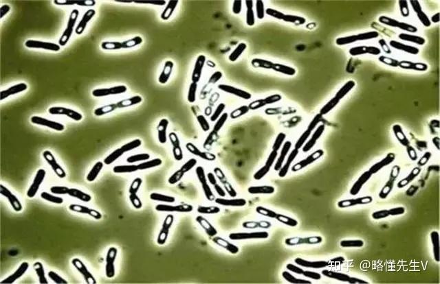 杀不死的炭疽恐怖的细菌芽孢