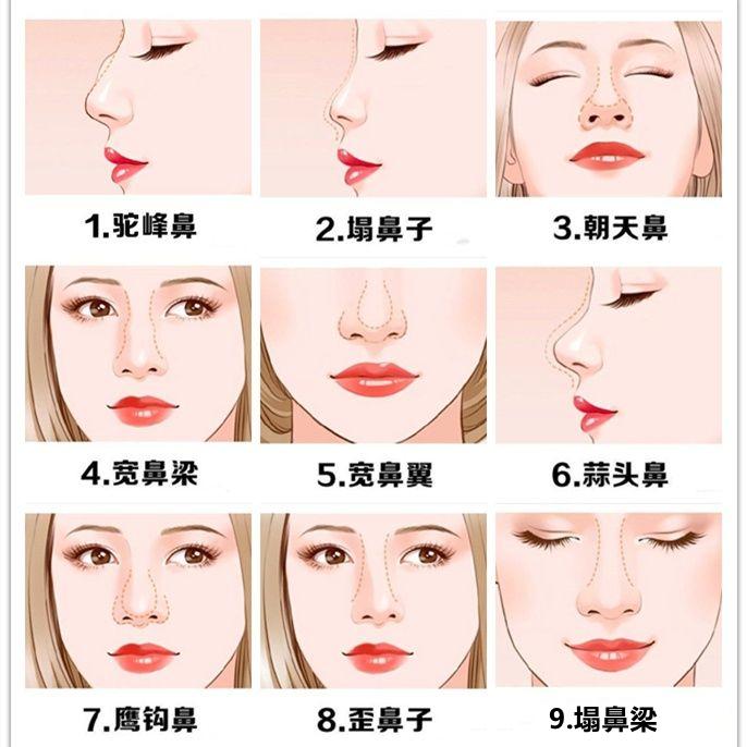 常见的鼻子问题、针对性的鼻整形方式：鼻翼缩小、垫高鼻梁、鼻骨内推、朝天鼻蒜头鼻处理 - 知乎