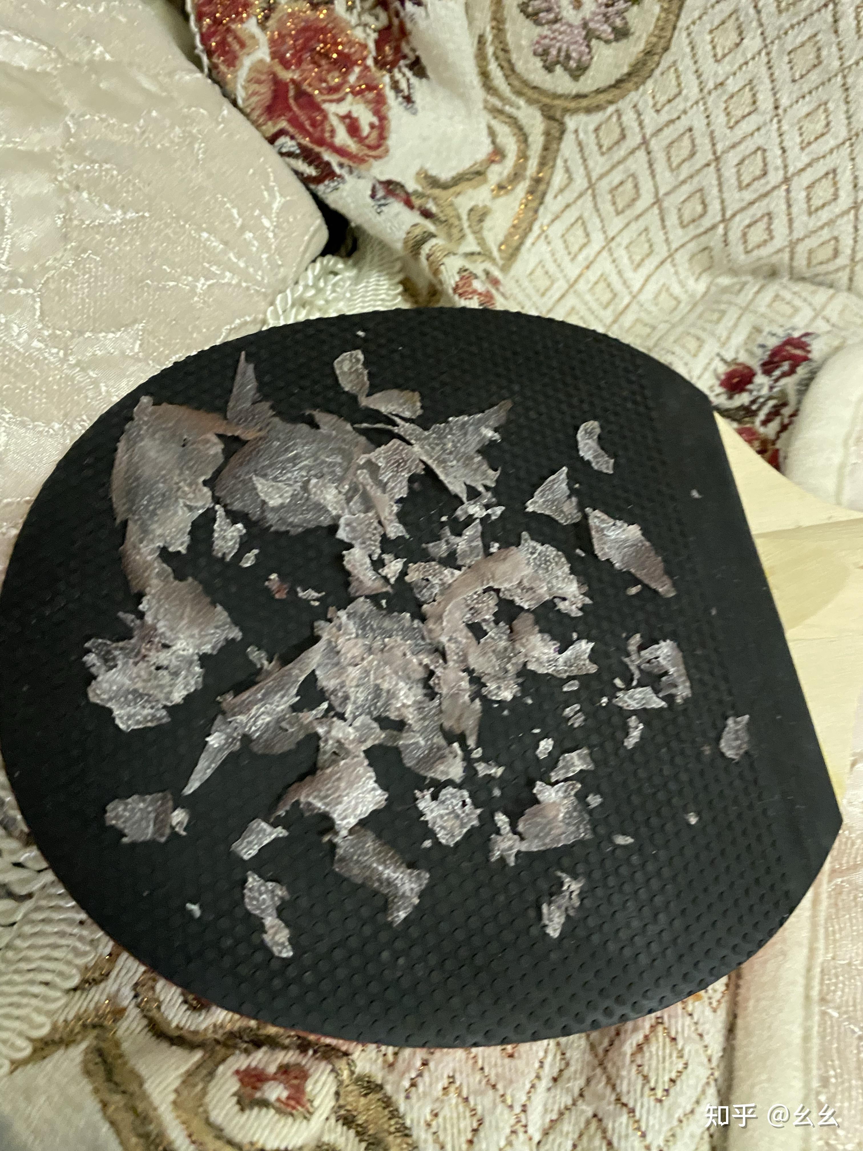 见过的最大头皮屑多大