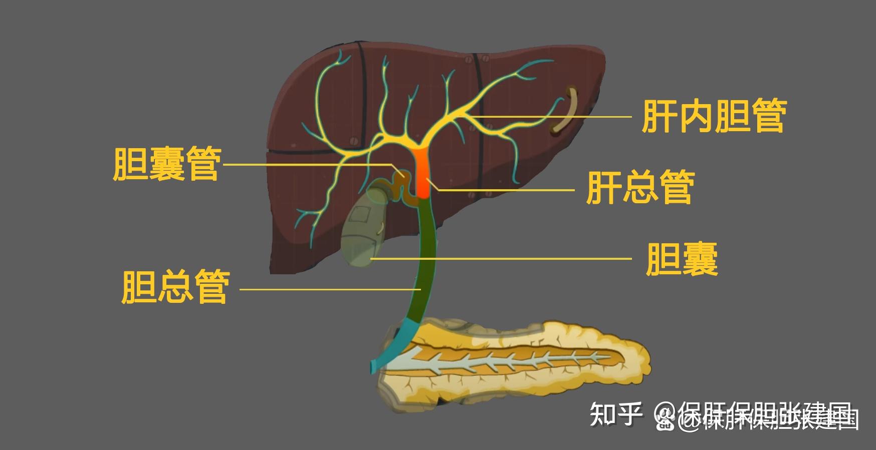 胆囊炎是怎么引起的? - 知乎