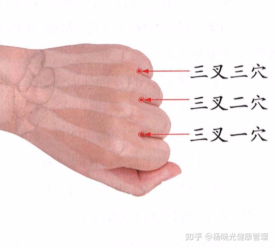 针灸治疗手指麻木的奇穴 - 知乎