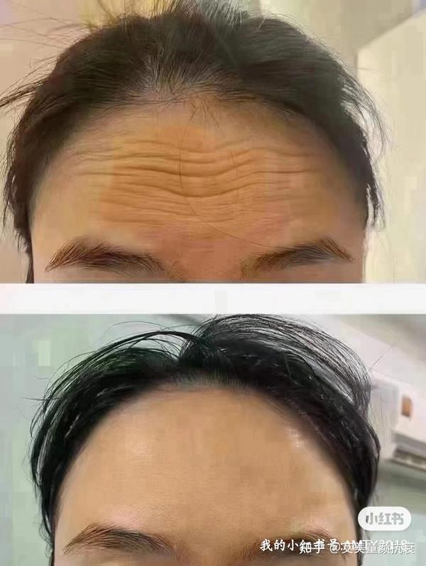 抗衰要趁早，艾美童颜帮你一站式解决衰老 - 知乎