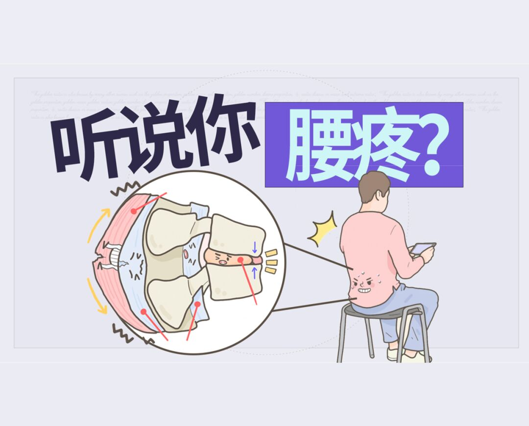 椎间盘突出患者日常饮食需要注意什么? 