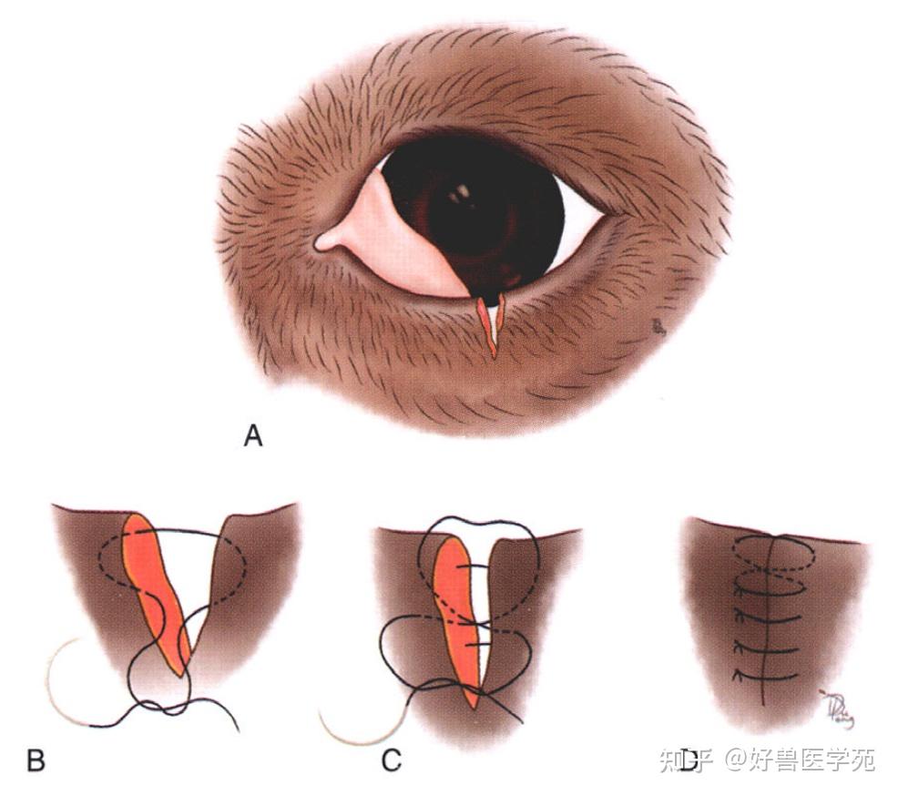 眼睑外伤切记使用标准双层缝合技术