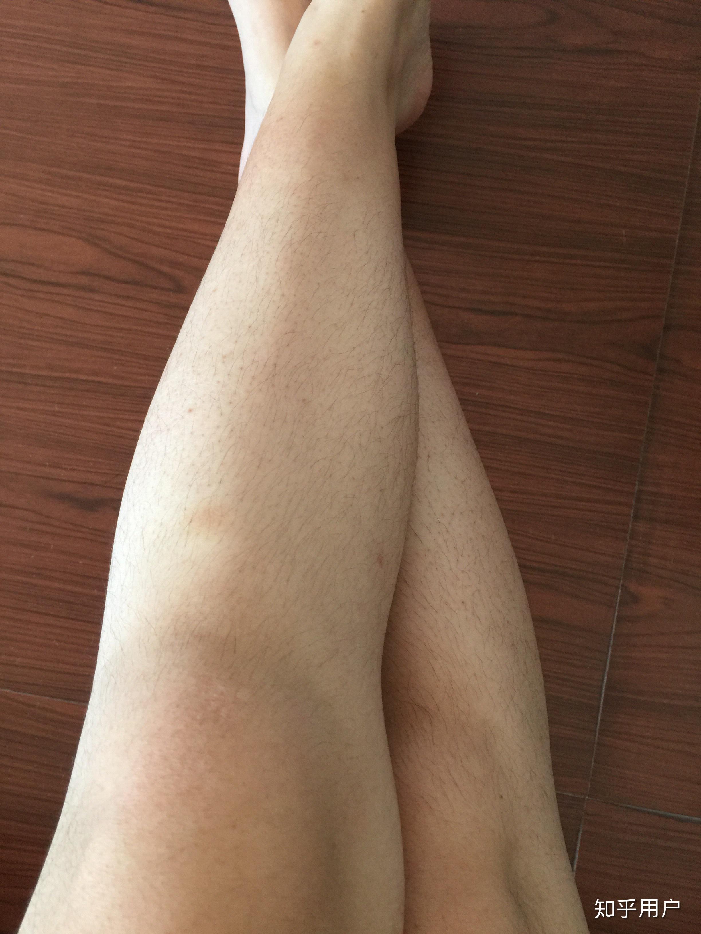 女生腿毛旺盛是怎样的人生体验