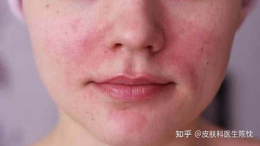 光电项目后反黑是怎么回事? - 知乎