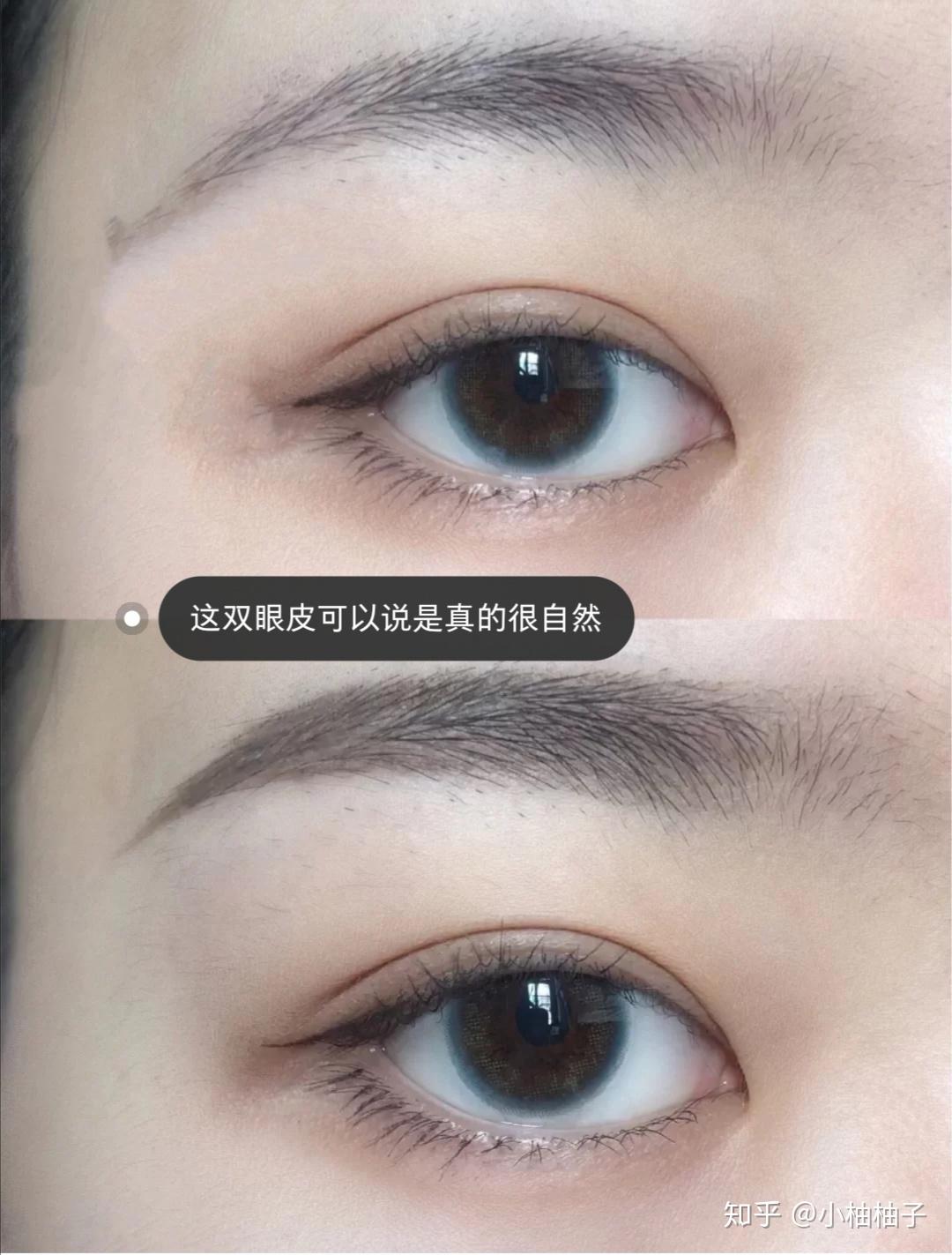 半藏森林的双眼皮是小平行还是小平扇? - 知乎