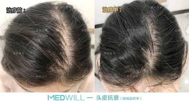 不同的发质的护理和保健，用什么样的洗发水更合适？ - 知乎