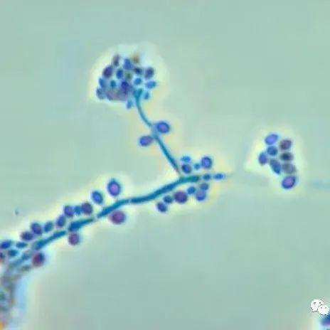 【真菌界全系列-16】盘菌亚门—粪壳菌纲(下) - 知乎