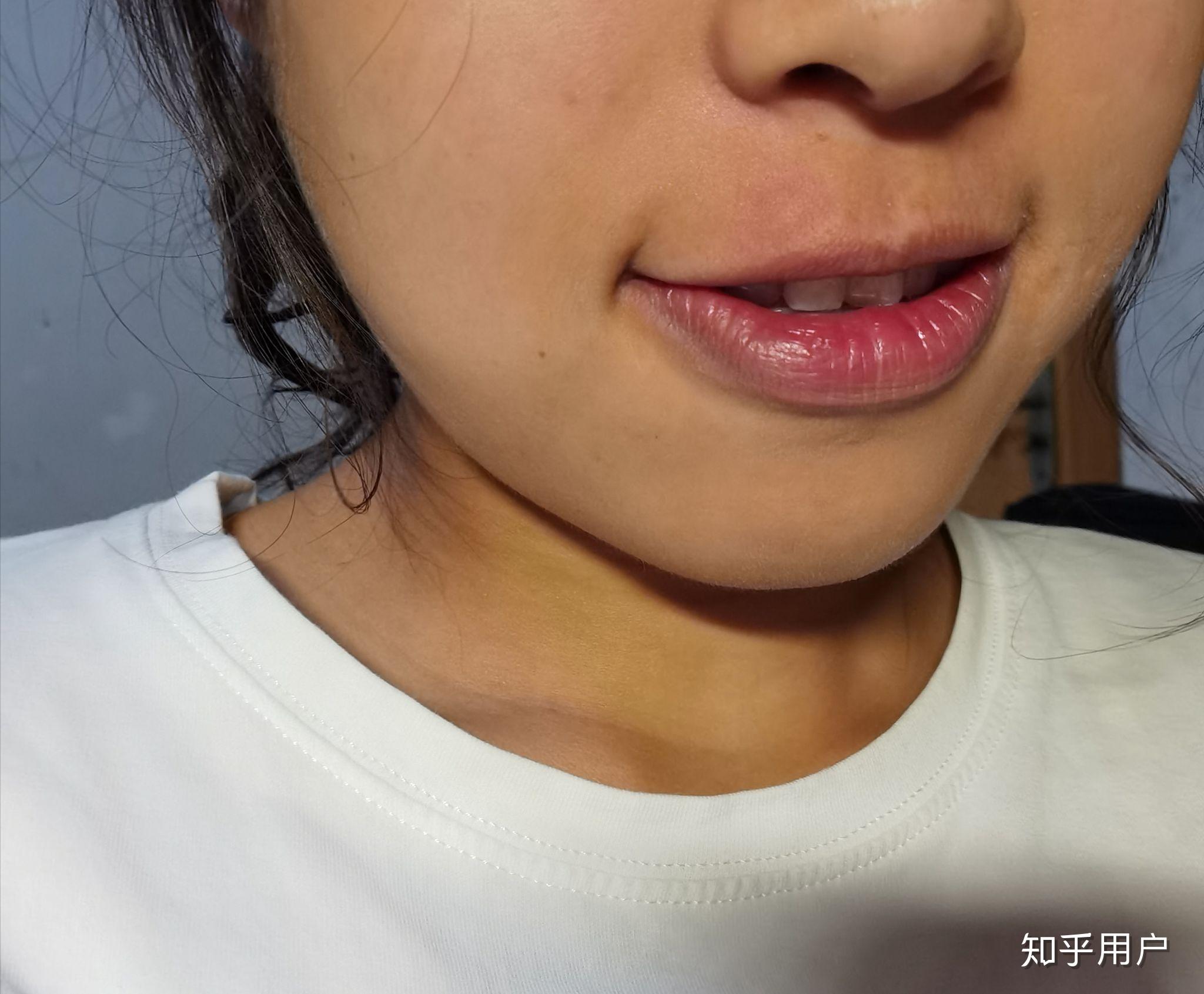 女生有唇毛可以用镊子拔么? - 知乎