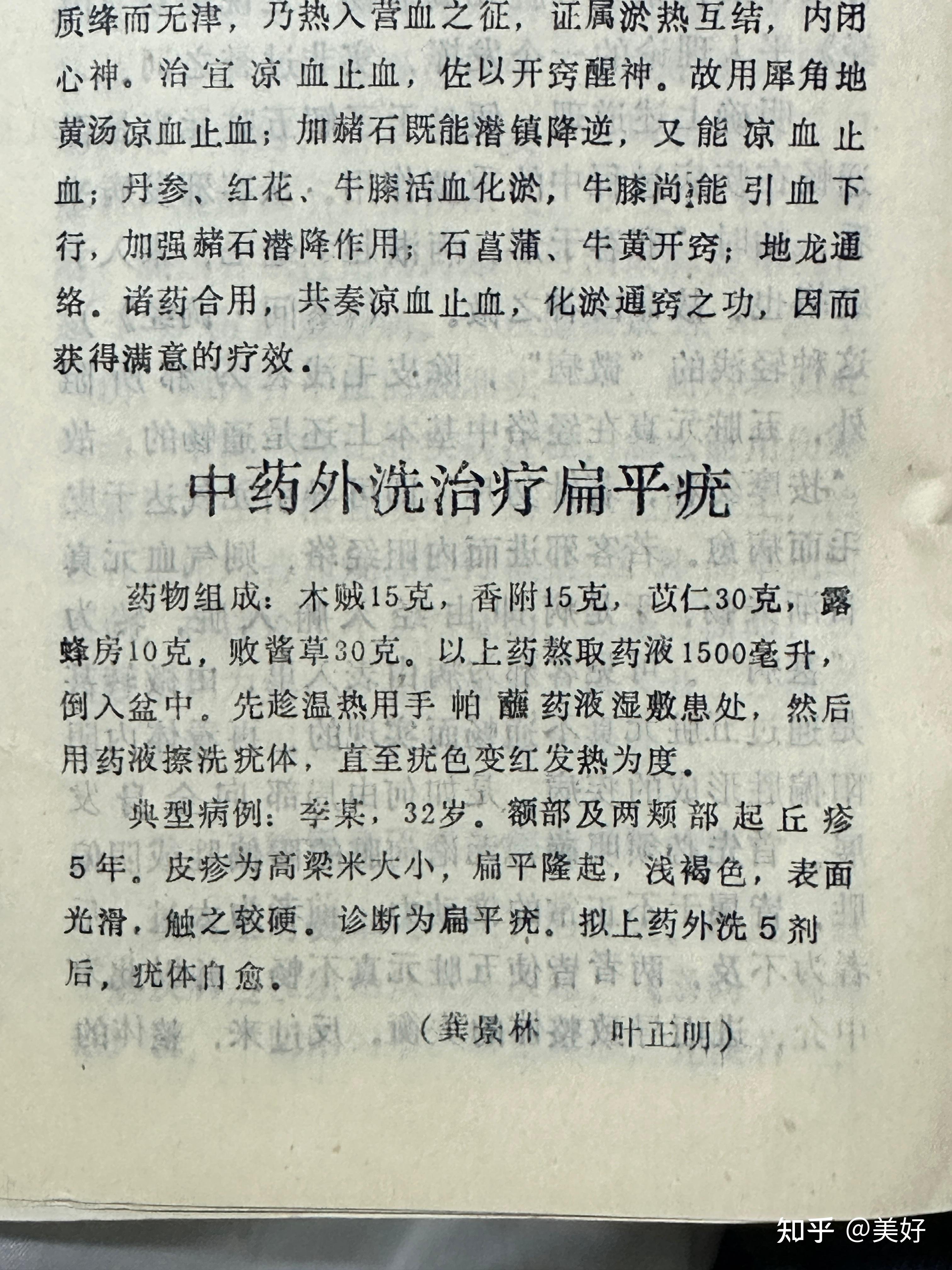 中药外洗治疗扁平疣