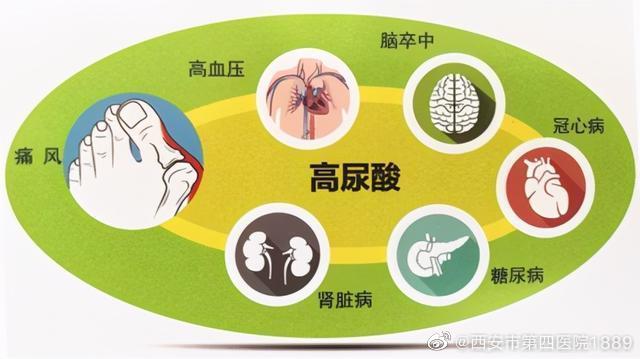 高尿酸血症hua的5大危害伤关节及皮肤结缔组织导致痛风