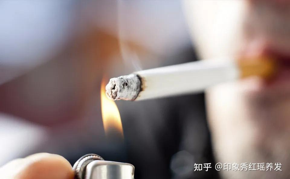 引起脱发的五宗罪