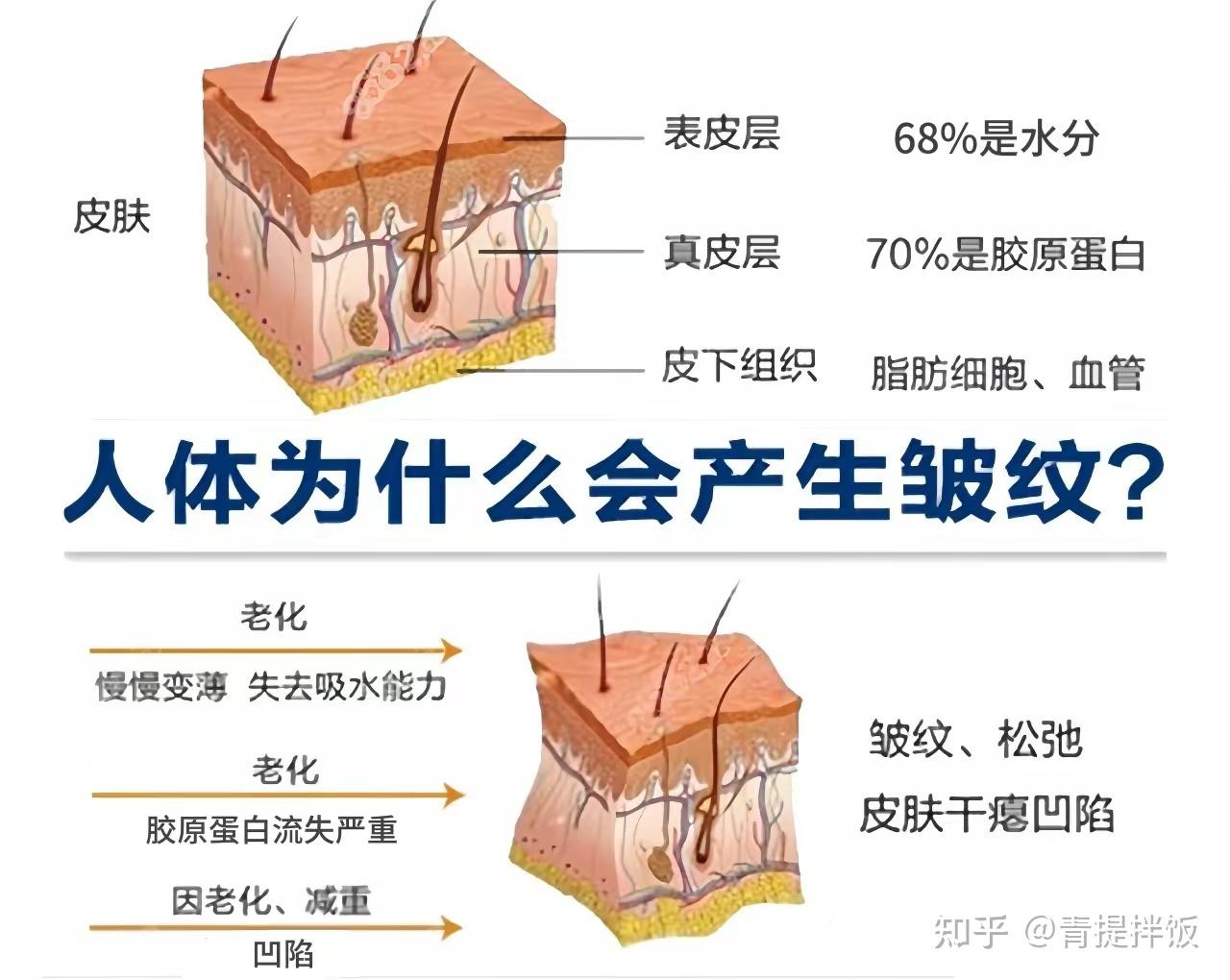 法令纹严重可以消除吗?用蓝铜胜肽去法令纹真有用吗? - 知乎