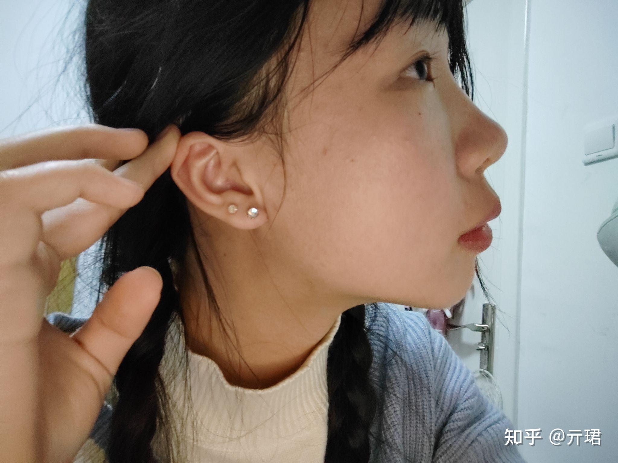 有眼尾沟的眼睛好看吗? - 知乎