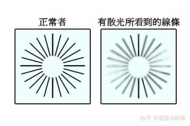 如何自测散光,如何自测散光度数