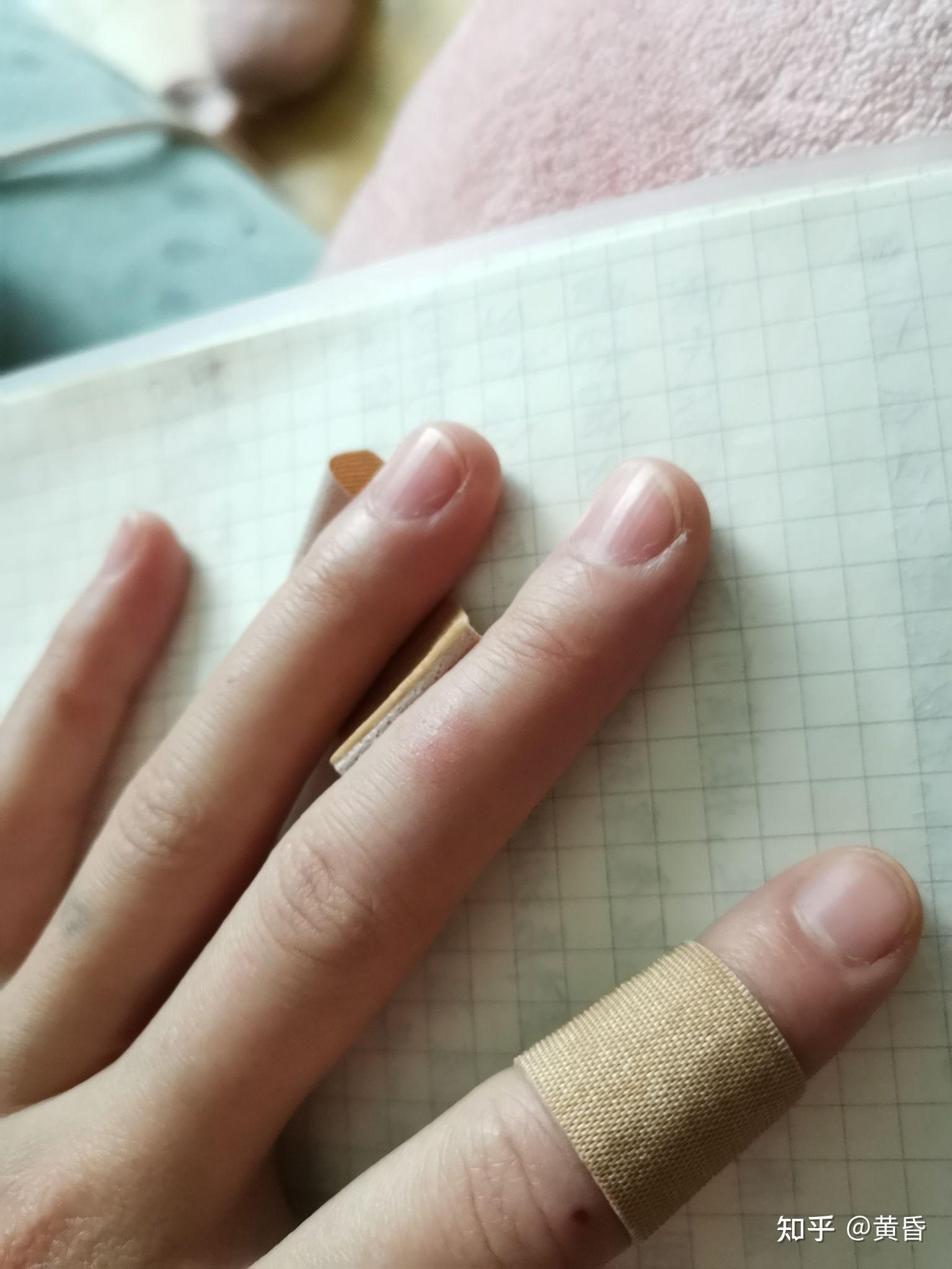 有没有被洗衣粉伤手的经历? - 知乎