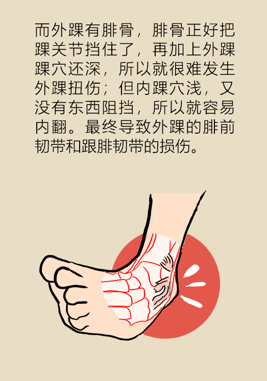 孩子崴脚比大人更危险快提醒粗心的父母们注意