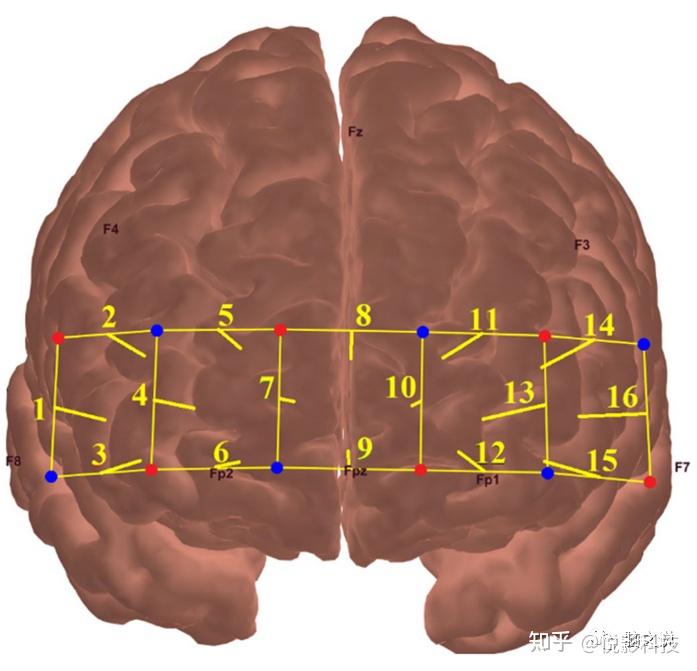 视空间工作记忆正常的老年人前额叶血流动力学特征 - 知乎
