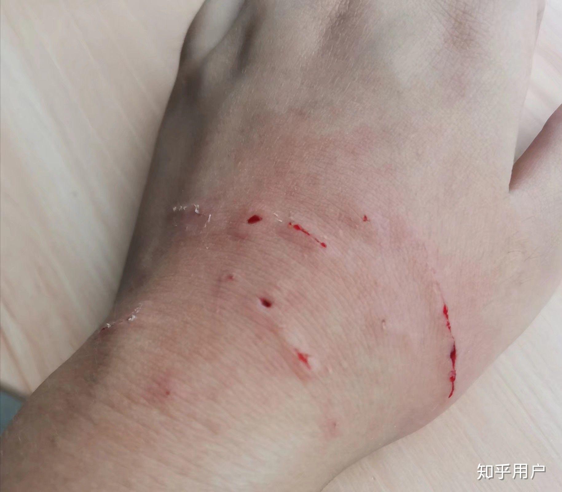 在猫咖被猫抓伤责任归谁