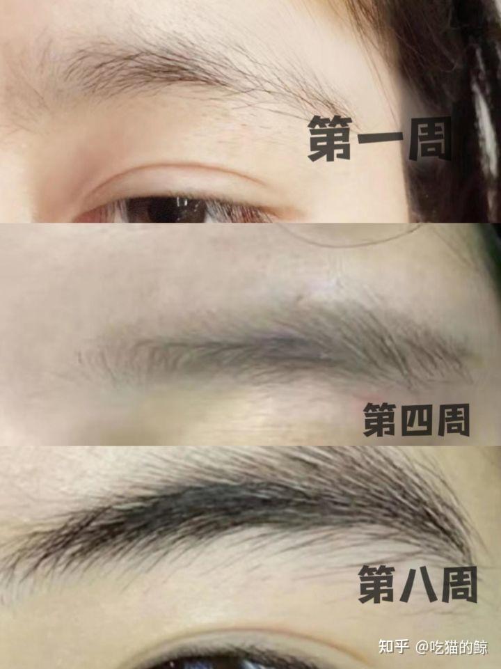 眉毛刮了会变浓吗