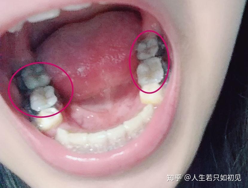 v2-c229327e108aa9afd6578876cb233920_r.jpg