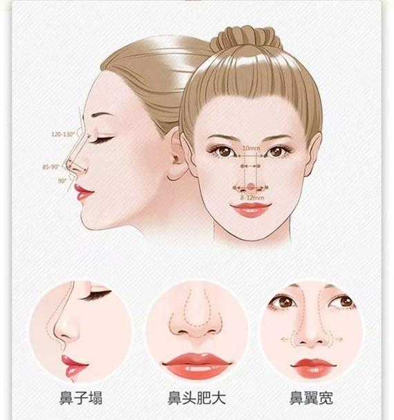 什么样的鼻子不适合整 v2-c23054a0417acdd4ed42d8ed712f1600_1440w.jpg?source=172ae18b