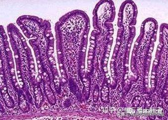 炎症性肠病IBD】猫吐毛球的本质原因是什么? - 知乎