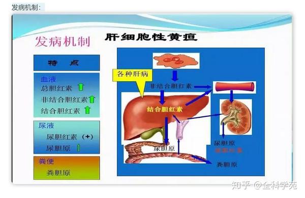从症状谈疾病系列——黄疸 - 知乎