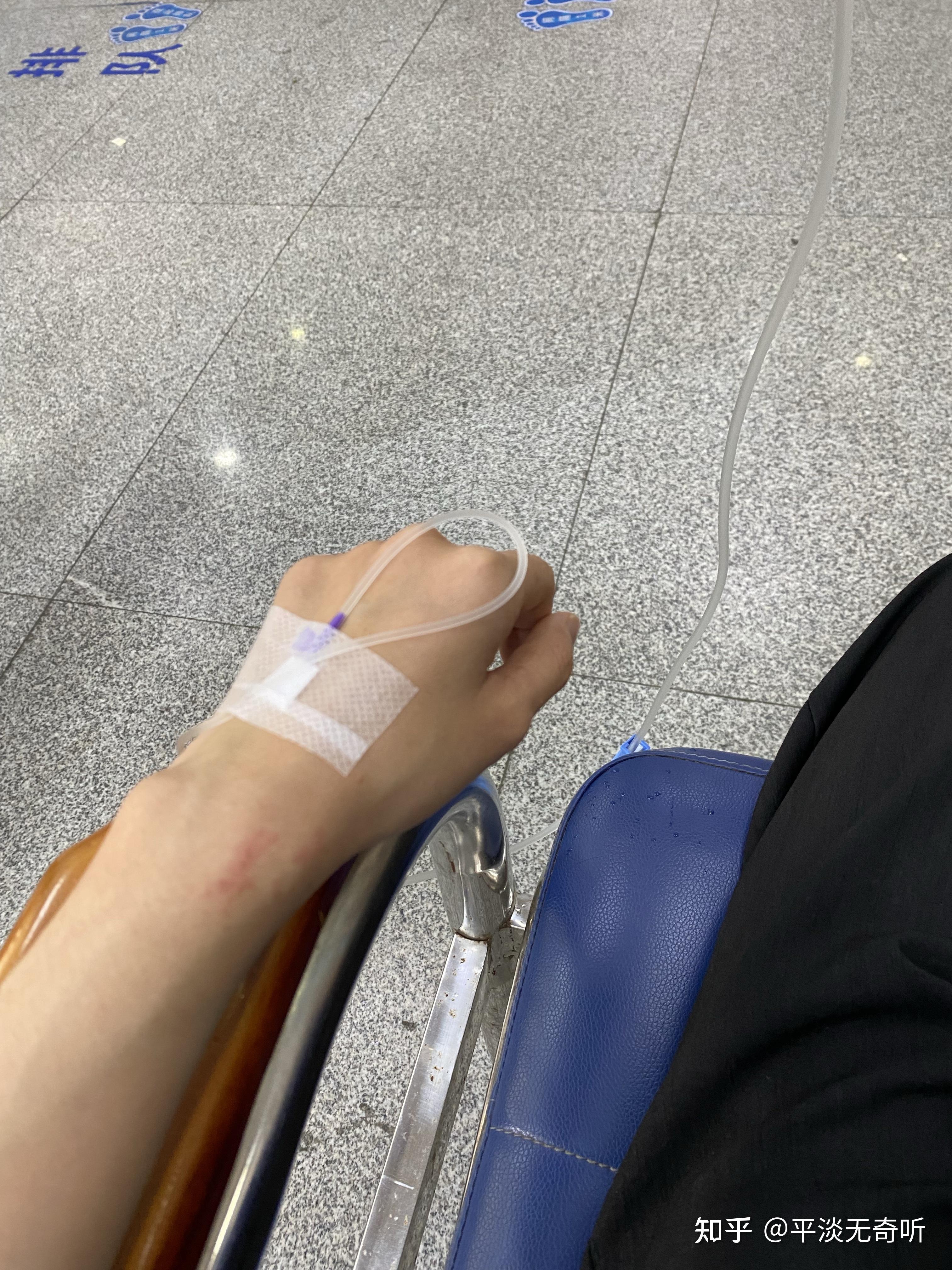 7月18日,我换了个医生.医生说我得打吊针,18 19 20日都要打.