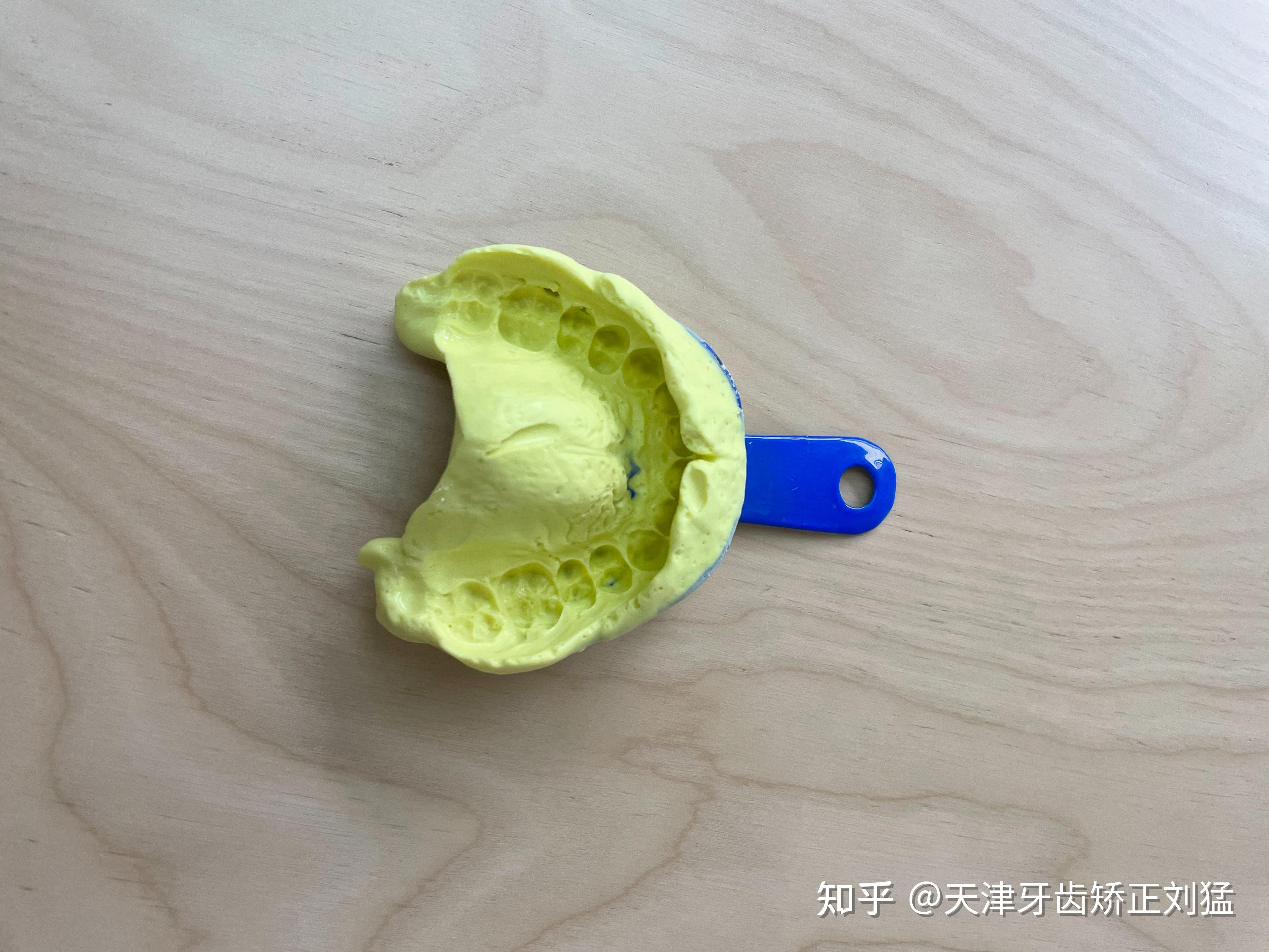 牙齿石膏模型有什么用? 