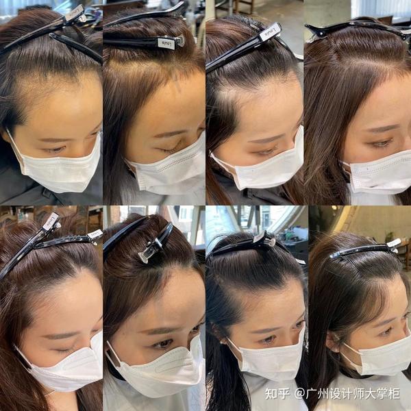 发际线高额头也高的女生适合什么样的发型?内附大量效果参考图!? - 知乎
