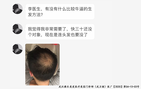最有效的生发方式 v2-c29d6ee0542ad8b831d2fe8c76223a98_r.jpg