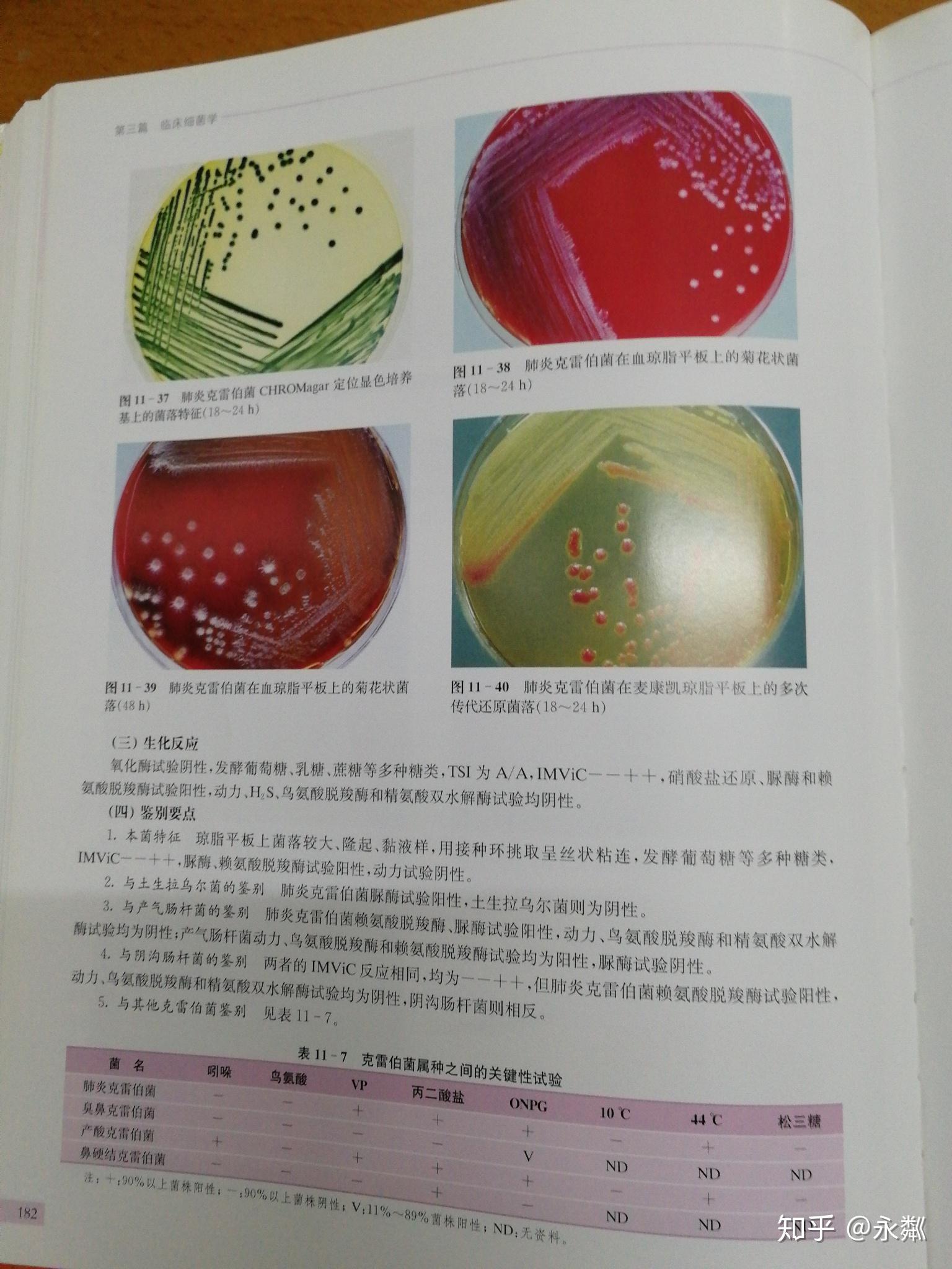 求问哪里能找到菌落颜色大全